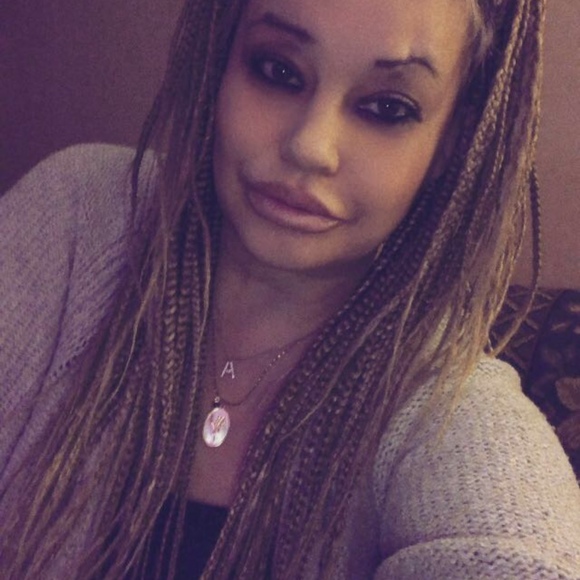 Meet your Posher, Alley - Picture 1 of 1